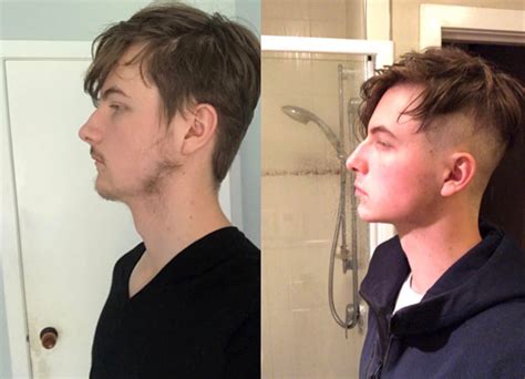 mewing results|does mewing work.